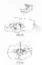 Fig. 48 - Burr hole plug having sidable clamping mechanism