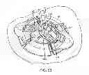Fig. 52 - Burr hole plug having sidable clamping mechanism