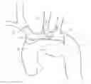 Fig. 01 - Universal endovascular grafts