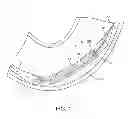 Fig. 02 - Medical device delivery systems and methods of use thereof
