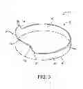 Fig. 04 - Medical device delivery systems and methods of use thereof