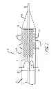 Fig. 02 - Inversion delivery device and method for a prosthesis