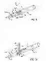 Fig. 07 - Inversion delivery device and method for a prosthesis