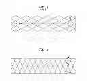 Fig. 02 - Multi-layer stent