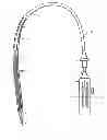 Fig. 02 - Methods and apparatus for endovascular heart valve replacement comprising tissue grasping elements