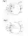 Fig. 02 - Intraocular lens
