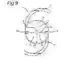 Fig. 06 - Intraocular lens