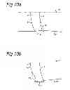 Fig. 07 - Intraocular lens