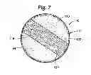 Fig. 06 - Soft filled prosthesis shell with discrete fixation surfaces
