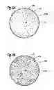 Fig. 07 - Soft filled prosthesis shell with discrete fixation surfaces