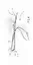 Fig. 07 - Hybrid double bundle ACL/PCL graft construct with a single graft