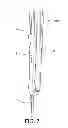 Fig. 08 - Hybrid double bundle ACL/PCL graft construct with a single graft