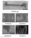 Fig. 05 - System and method for forming bone, ligament, and bone-ligament constructs