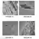 Fig. 06 - System and method for forming bone, ligament, and bone-ligament constructs