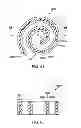 Fig. 33 - Disk fusion implant
