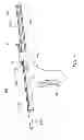 Fig. 07 - Insertion tools and methods for minimally invasive spinal fusion cage
