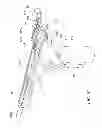 Fig. 09 - Insertion tools and methods for minimally invasive spinal fusion cage