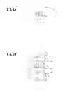 Fig. 09 - Implant and implant assembly