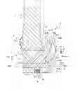 Fig. 01 - Artificial knee joint implant