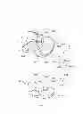 Fig. 03 - Artificial knee joint implant