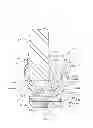 Fig. 04 - Artificial knee joint implant