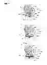 Fig. 08 - Artificial knee joint implant