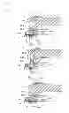 Fig. 09 - Artificial knee joint implant