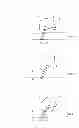Fig. 10 - Artificial knee joint implant