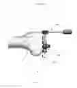 Fig. 03 - Anatomically guided instrumentation for trochlear groove replacement