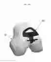 Fig. 12 - Anatomically guided instrumentation for trochlear groove replacement