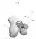 Fig. 25 - Anatomically guided instrumentation for trochlear groove replacement
