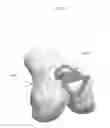 Fig. 26 - Anatomically guided instrumentation for trochlear groove replacement