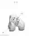 Fig. 29 - Anatomically guided instrumentation for trochlear groove replacement
