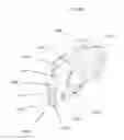 Fig. 32 - Anatomically guided instrumentation for trochlear groove replacement