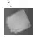 Fig. 01 - Cartilage mosaic compositions and methods