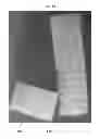 Fig. 14 - Cartilage mosaic compositions and methods