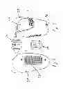 Fig. 06 - Prosthesis assembly with adjustable diameter socket