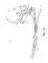 Fig. 05 - Prosthetic foot with enhanced stability and elastic energy return