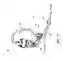 Fig. 11 - Prosthetic foot with enhanced stability and elastic energy return