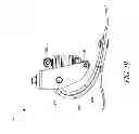 Fig. 17 - Prosthetic foot with enhanced stability and elastic energy return