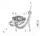 Fig. 19 - Prosthetic foot with enhanced stability and elastic energy return