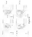 Fig. 33 - Coaching aid for golf