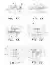 Fig. 06 - Surgical guide and method