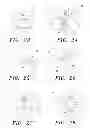 Fig. 07 - Surgical guide and method
