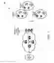 Fig. 02 - Distributing intelligence across networks