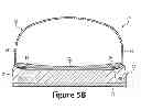 Fig. 07 - Method of lasting an article of footwear