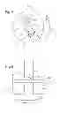 Fig. 04 - Device for fixing insulating layers and insulation assembly system