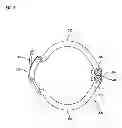 Fig. 07 - Juicer with simple assembly and disassembly of housing