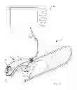 Fig. 02 - Endoscope bending section control mechanism