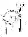 Fig. 06 - Ballooned ventilation tube cleaning device